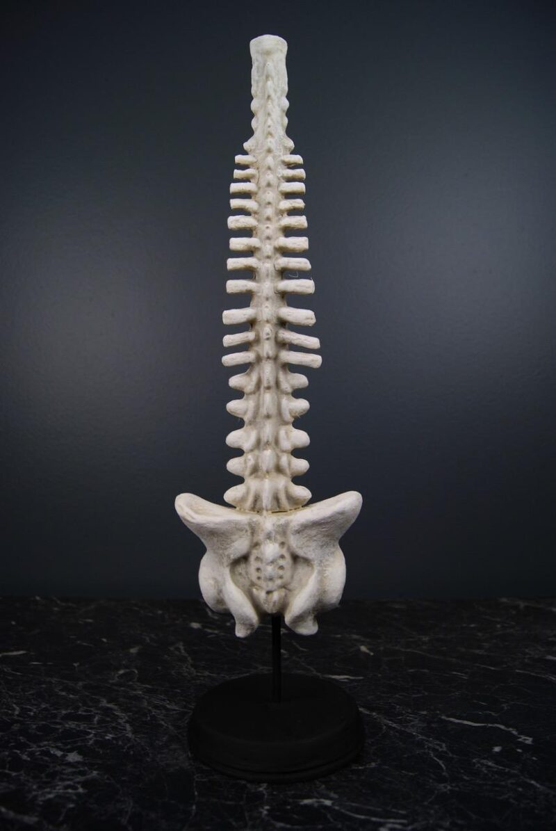 SPINE ON BASE NAT